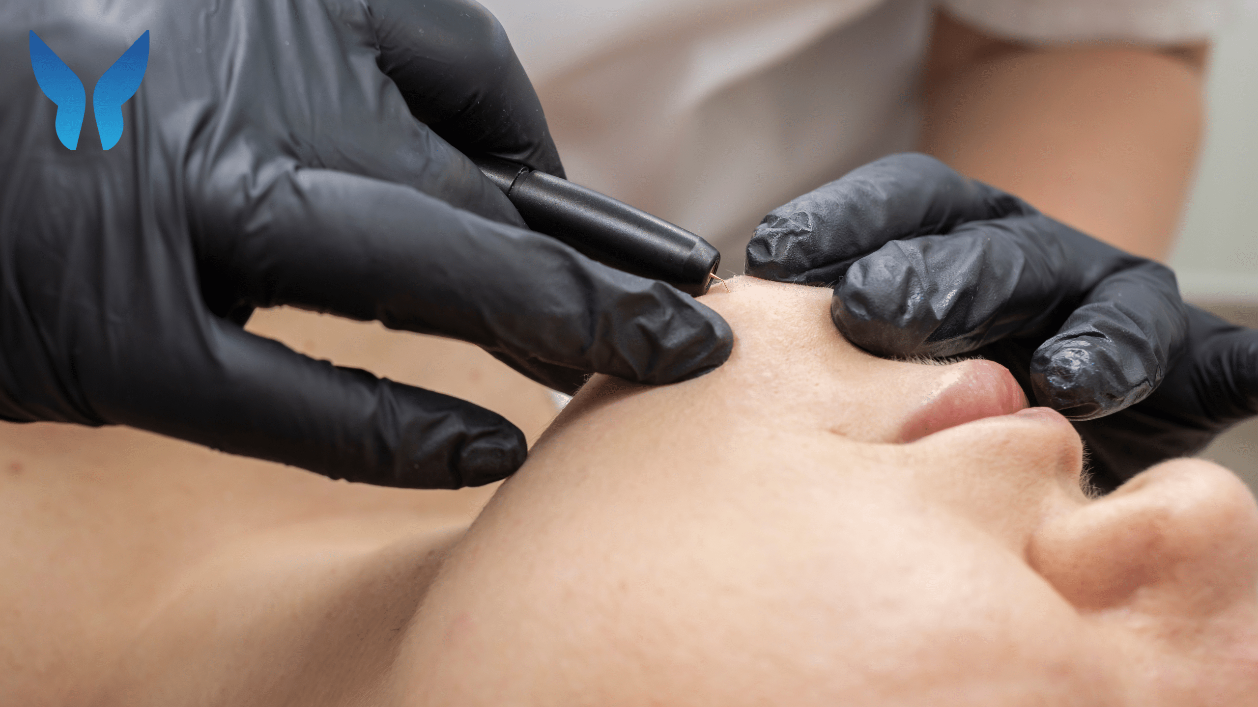 Enhancing Your Jawline with Chin Fillers: What to Expect