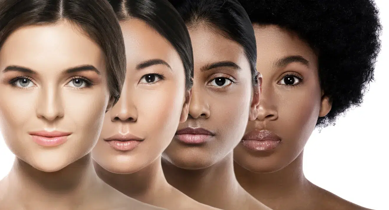 Skin tones of women laser hair removal