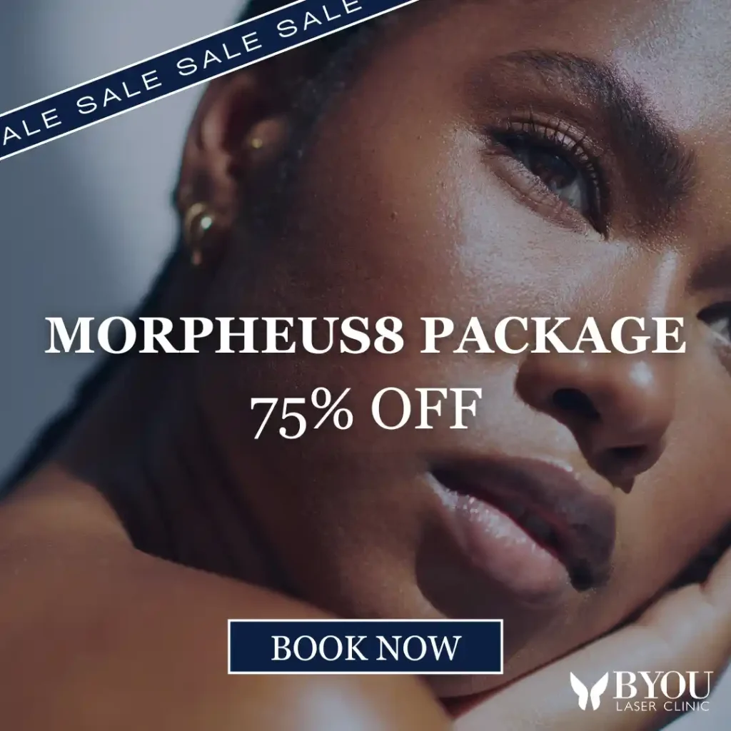 Morpheus8 up to 75% off Banner