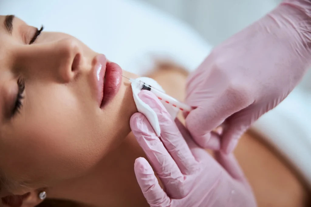 Lip filler needle placed on patients lips