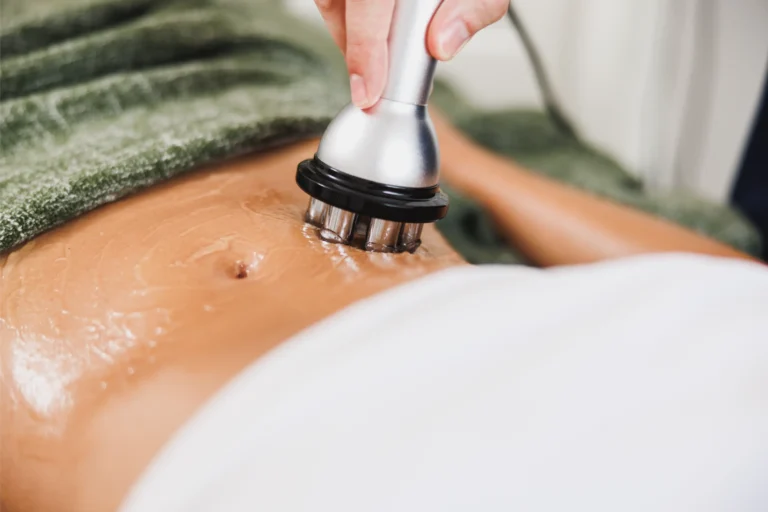 Client's stomach with radio frequency machine applied to belly area