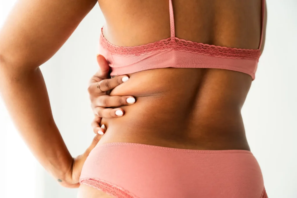 Woman holding stubborn fat