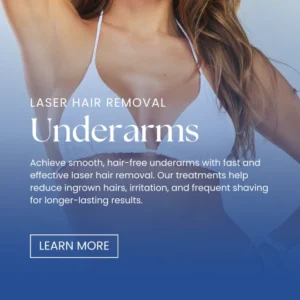 Laser Hair Remvoal Underarms