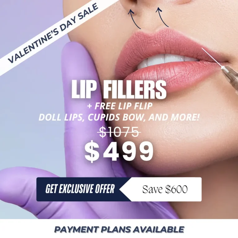 Lip Fillers + Free Lip Flip $499