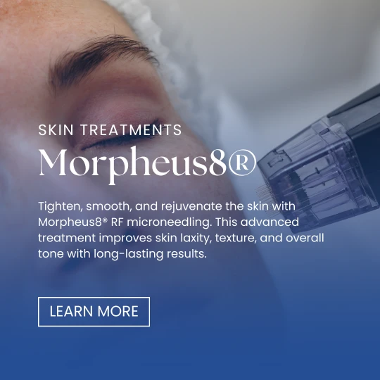 Skin Treatments - Morpheus8 Banner