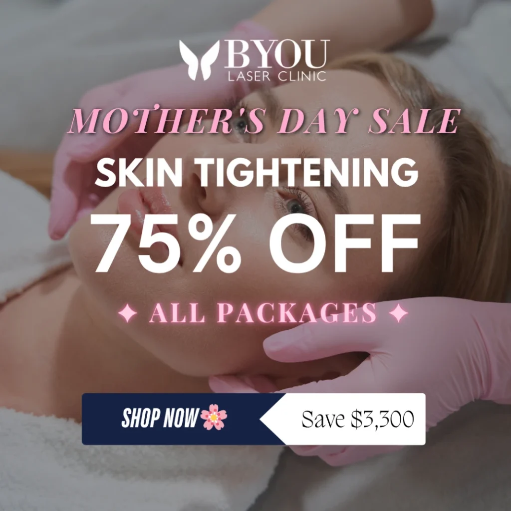 Skin Tightening 75% OFF Mother's Day Box Banner