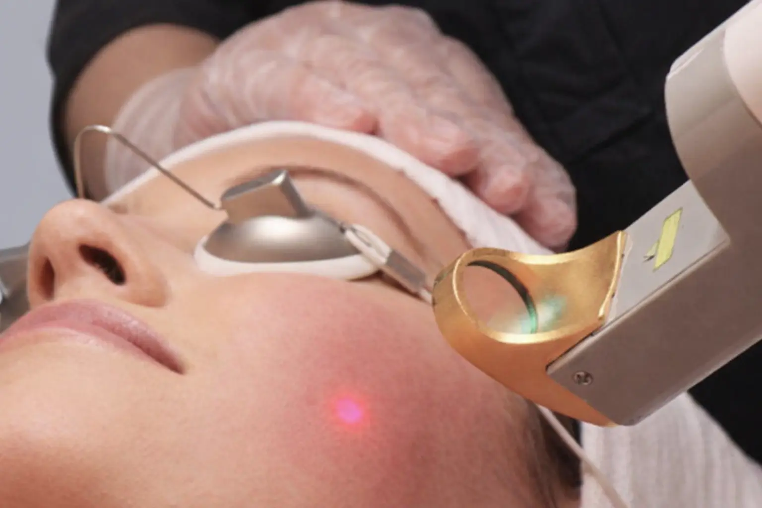 Skin treatments at BYou Laser Clinic Manhattan Murray Hill