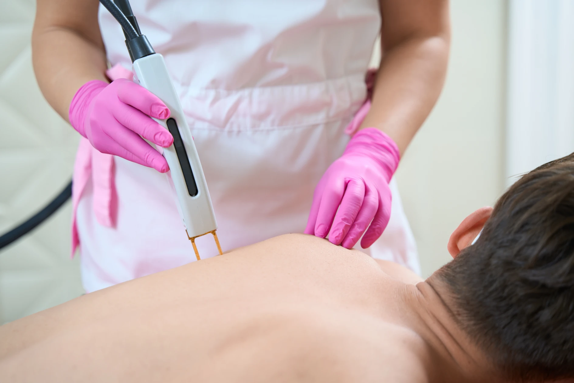 Laser hair removal for back and chest — BYou Laser Clinic