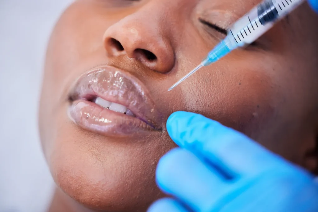 Woman getting lip filler treatment