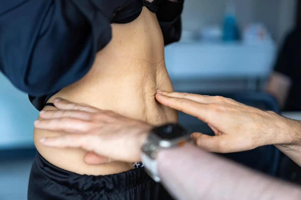 person touching loose skin on stomach