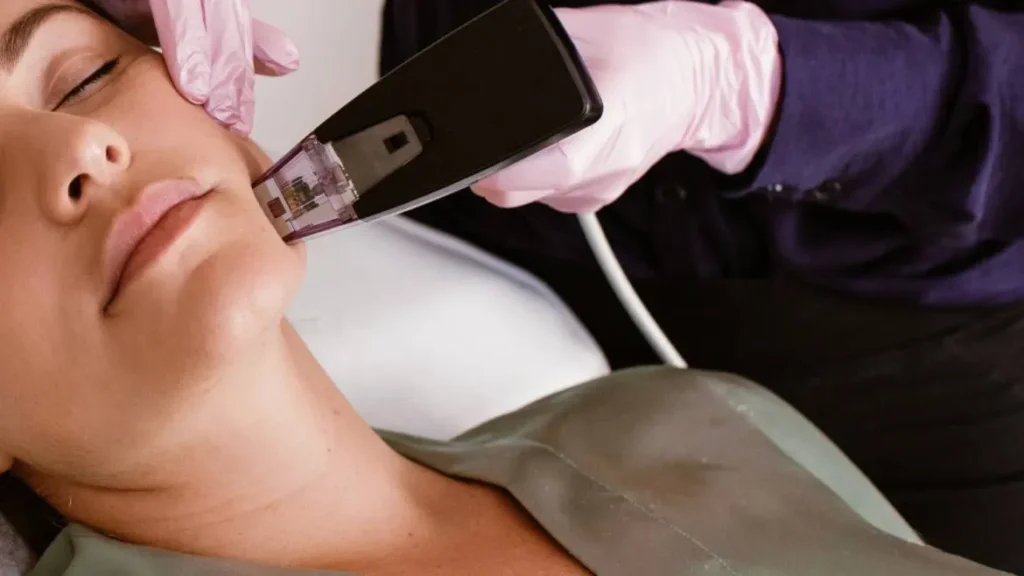 Client getting Morhpeus8 treatment