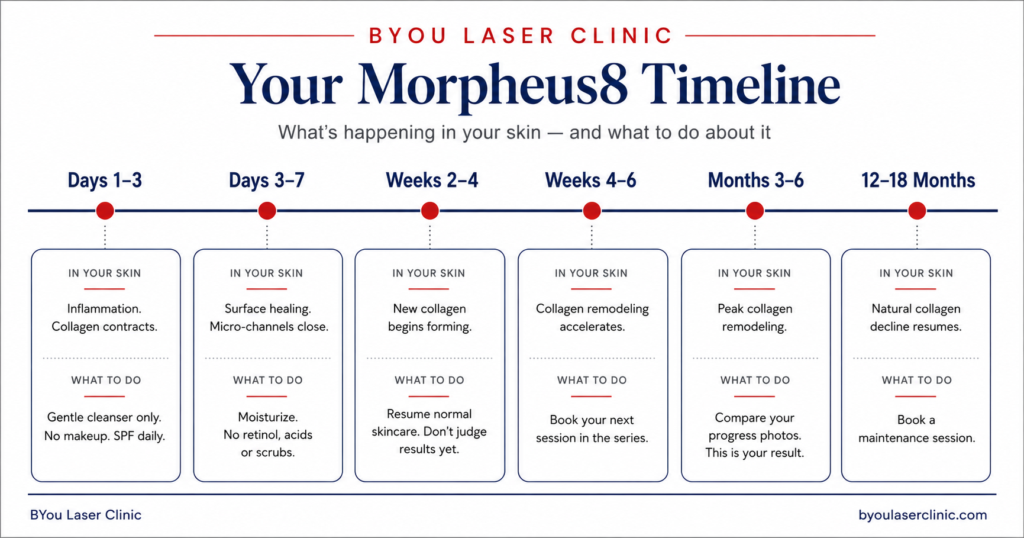 morpheus8-results-timeline-infographic2.png Morpheus8 results timeline infographic showing skin healing week by week