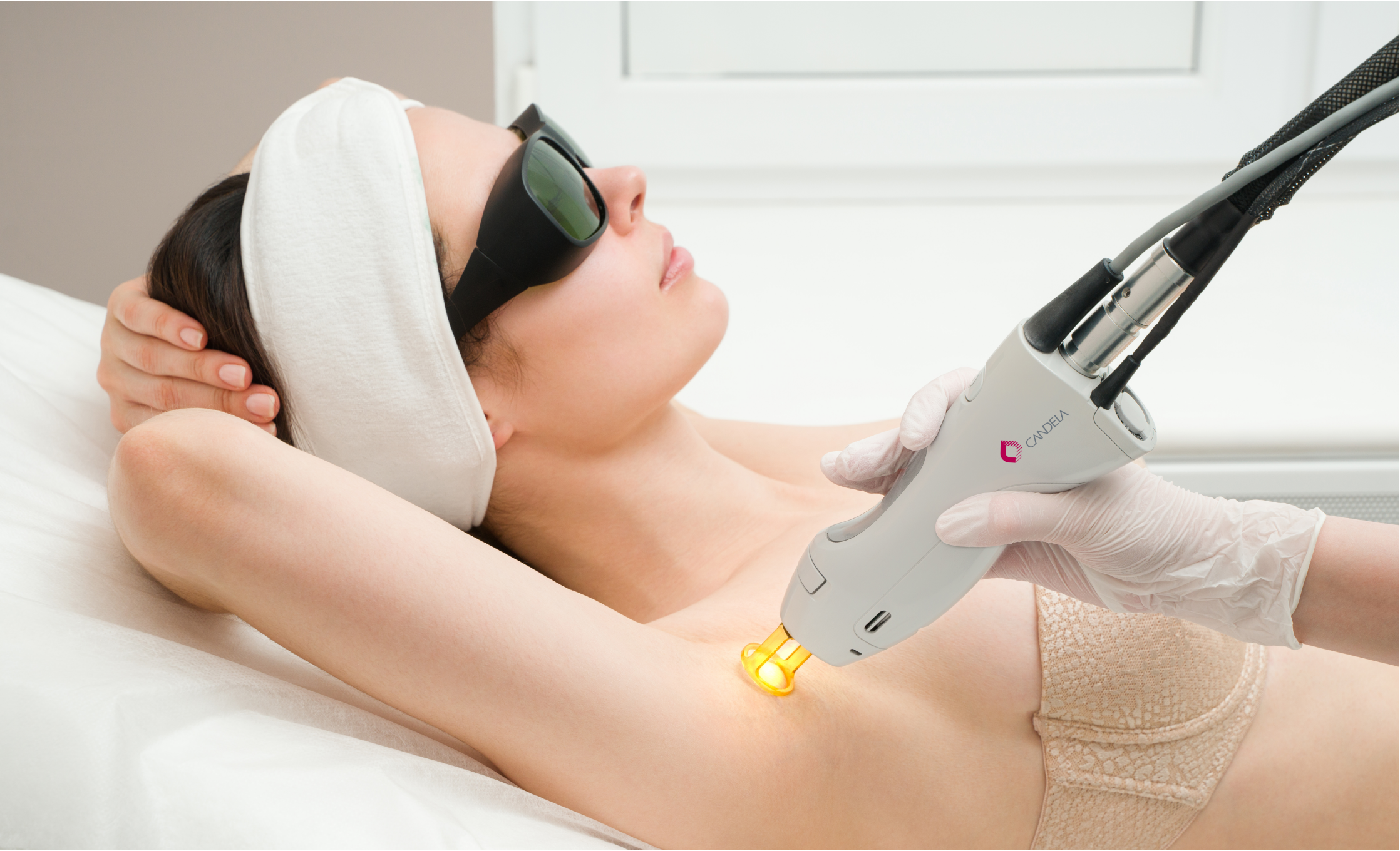 Candela GentleMax Pro laser hair removal treatment at BYou Laser Clinic