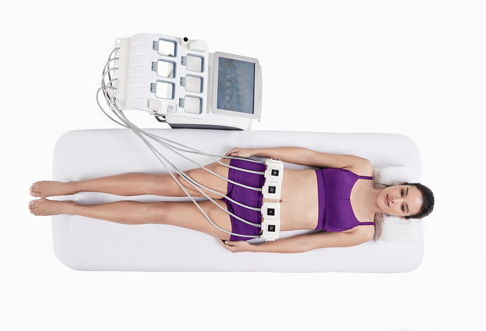 truSculpt iD body contouring treatment at BYou Laser Clinic